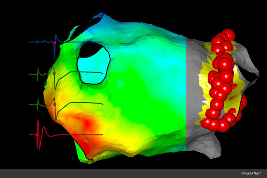 New data platform targets heart disorders